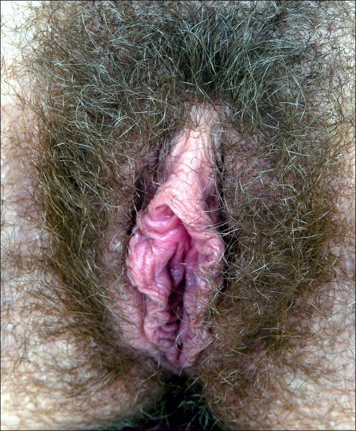 Самые Волосатые Женские Половые Органы Порно Фото