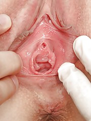 Порно фото на приеме у гинеколога