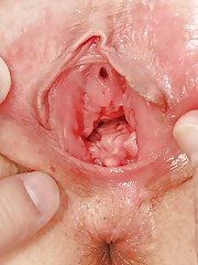 Гинеколог раздвигает вагину и видно внутренности
